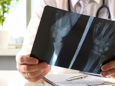 Calcium for Healthy Bones is Obvious, but You Also Need Vitamin K2!