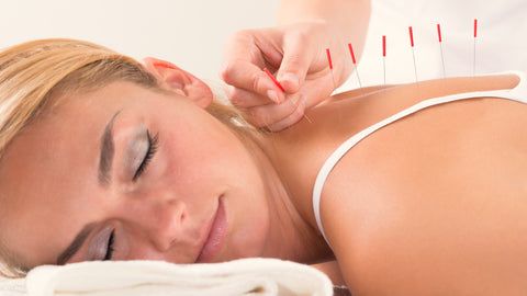Best Acupuncture Techniques for Back Pain: Restore Your Comfort